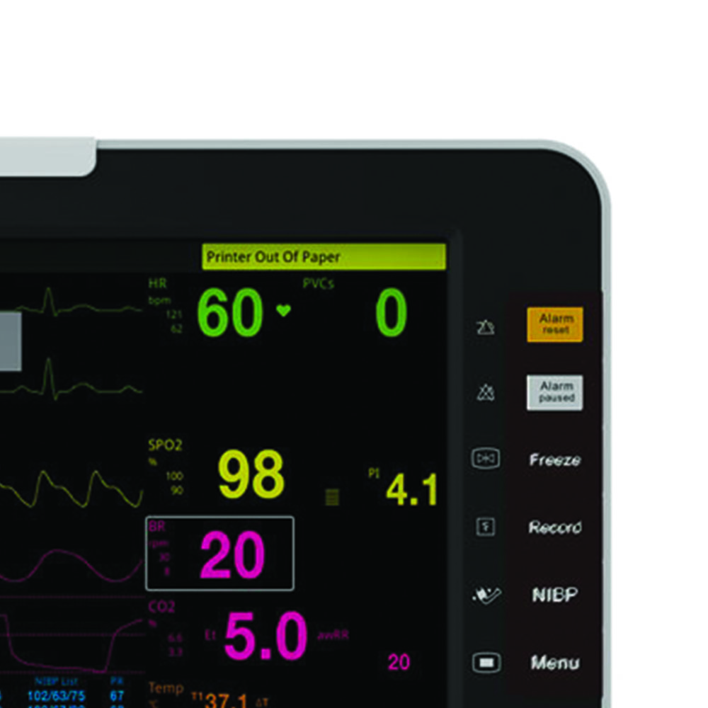 Patientenmonitore - Betterlife Vitavue Multiparameter-patientenmonitor 10-zoll-touchscreen-display